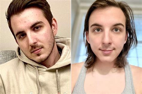 YouTuber Chris Tyson has shared before and after pictures since starting hormone replacement therapy. The influencer, known for regularly appearing on MrBeast 's YouTube channel, shared side-by-side images with their nearly 300,000 followers. Hormone replacement therapy typically helps gender nonconforming people achieve a more …